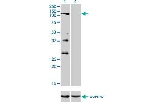 Western blot analysis of PTPRN2 over-expressed 293 cell line, cotransfected with PTPRN2 Validated Chimera RNAi (Lane 2) or non-transfected control (Lane 1). (PTPRN2 antibody  (AA 108-212))