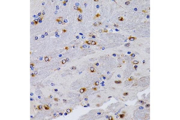 TFF1 antibody  (pSer2)