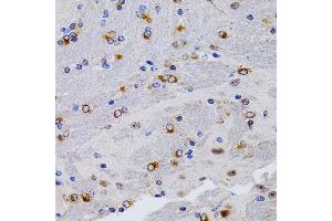 Immunohistochemistry of paraffin-embedded mouse brain using TFF1/pS2 antibody (ABIN3015565, ABIN3015566, ABIN3015567 and ABIN6218896) at dilution of 1:200 (40x lens). (TFF1 antibody  (pSer2))