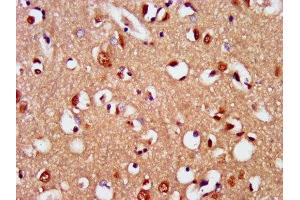 IHC image of ABIN7169728 diluted at 1:400 and staining in paraffin-embedded human brain tissue performed on a Leica BondTM system. (SIM2 antibody  (AA 347-433))