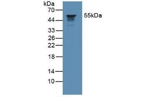 Detection of CORO1A in Human Jurkat Cells using Polyclonal Antibody to Coronin 1A (CORO1A) (Coronin 1a antibody  (AA 7-204))