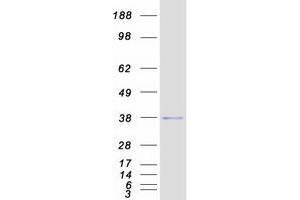 Hairy/enhancer-of-Split Related with YRPW Motif 2 (HEY2) protein (Myc-DYKDDDDK Tag)