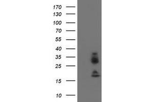 Western Blotting (WB) image for anti-Immunoglobulin J Polypeptide, Linker Protein For Immunoglobulin alpha and mu Polypeptides (IGJ) antibody (ABIN1498836) (IGJ antibody)