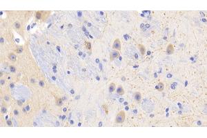 Detection of PR3 in Mouse Cerebrum Tissue using Polyclonal Antibody to Proteinase 3 (PR3) (PRTN3 antibody  (AA 24-249))