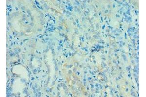 Immunohistochemistry of paraffin-embedded human kidney tissue using ABIN7144121 at dilution of 1:100 (ANGPTL4 antibody  (AA 26-406))