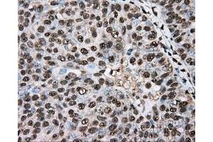 Immunohistochemical staining of paraffin-embedded colon tissue using anti-BSG mouse monoclonal antibody. (CD147 antibody)