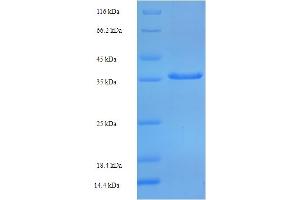SDS-PAGE (SDS) image for TBP-Like 1 (TBPL1) (AA 1-185), (partial) protein (His-SUMO Tag) (ABIN5710462)