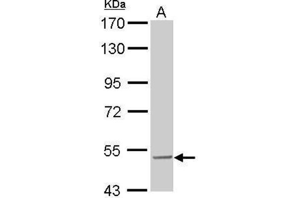 SESN3 antibody