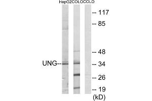 Western blot analysis of extracts from HepG2 cells and COLO cells, using UNG antibody. (UNG antibody  (Internal Region))