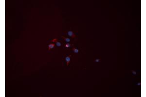 ABIN6276446 staining HEPG2 cells by ICC/IF. (Hexokinase 2 antibody  (C-Term))