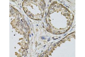 Immunohistochemistry of paraffin-embedded Human prostate using Cyclin A2 Polyclonal Antibody at dilution of 1:100 (40x lens). (Cyclin A antibody)