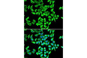 Immunofluorescence analysis of A549 cells using TP53 antibody. (p53 antibody  (AA 1-110))