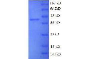SDS-PAGE (SDS) image for Indolethylamine N-Methyltransferase (INMT) (AA 1-263), (full length) protein (His-SUMO Tag) (ABIN4975700)