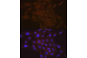 Immunofluorescence analysis of C6 cells using SMC4 Rabbit mAb (ABIN7270618) at dilution of 1:100 (40x lens). (SMC4 antibody)