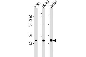 Lane 1: HeLa, Lane 2: HL-60, Lane 3: Jurkat cell lysate (20µg) probed with bsm-51309M CDK2 (1534CT665. (CDK2 antibody)