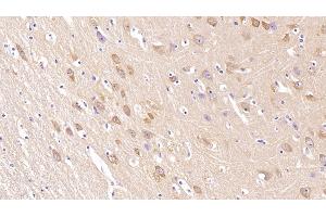 Detection of NRGN in Human Cerebrum Tissue using Monoclonal Antibody to Neurogranin (NRGN) (Neurogranin antibody  (AA 1-67))