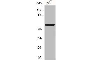 Western Blot analysis of Hela cells using GM2/GD2 synthase Polyclonal Antibody (B4GALNT1 antibody  (Internal Region))