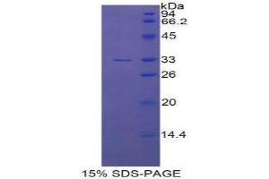 SDS-PAGE (SDS) image for Endothelin-Converting Enzyme 1 (ECE1) (AA 469-721) protein (His tag) (ABIN2124720) (ECE1 Protein (AA 469-721) (His tag))