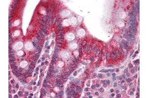 Human Small Intestine: Formalin-Fixed, Paraffin-Embedded (FFPE) (DR3/LARD antibody)