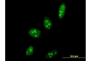 Immunofluorescence of monoclonal antibody to PELP1 on HeLa cell. (PELP1 antibody  (AA 337-410))