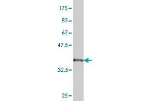 Western Blot detection against Immunogen (36. (BTG2 antibody  (AA 59-158))