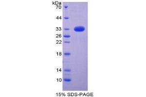 SDS-PAGE (SDS) image for Notch 4 (NOTCH4) (AA 1715-2001) protein (His tag) (ABIN2126126)