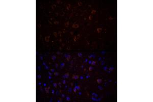 Immunofluorescence analysis of Rat brain using CHAT antibody (ABIN7266344) at dilution of 1:100 (40x lens). (Choline Acetyltransferase antibody  (AA 331-630))