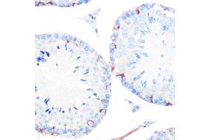 Immunohistochemistry of paraffin-embedded mouse testis using γ-Catenin Rabbit mAb (ABIN1683043, ABIN3018625, ABIN3018626 and ABIN7101634) at dilution of 1:100 (40x lens). (JUP antibody)