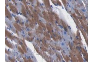 Detection of GLRX3 in Mouse Cardiac Muscle Tissue using Polyclonal Antibody to Glutaredoxin 3 (GLRX3)
