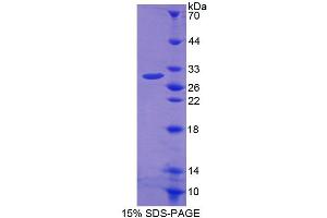 Image no. 1 for ATP-Binding Cassette, Sub-Family A (ABC1), Member 2 (ABCA2) (AA 2201-2434) protein (His tag) (ABIN4989895)