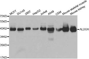 Western blot analysis of extracts of various cell lines, using ALDOA antibody (ABIN5970490) at 1/1000 dilution. (ALDOA antibody)