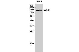 Western Blotting (WB) image for anti-Protein Kinase, CGMP-Dependent, Type II (PRKG2) (Ser363), (Thr359) antibody (ABIN3183890) (PRKG2 antibody  (Ser363, Thr359))