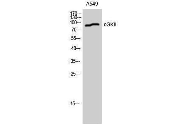 PRKG2 抗体  (Ser363, Thr359)