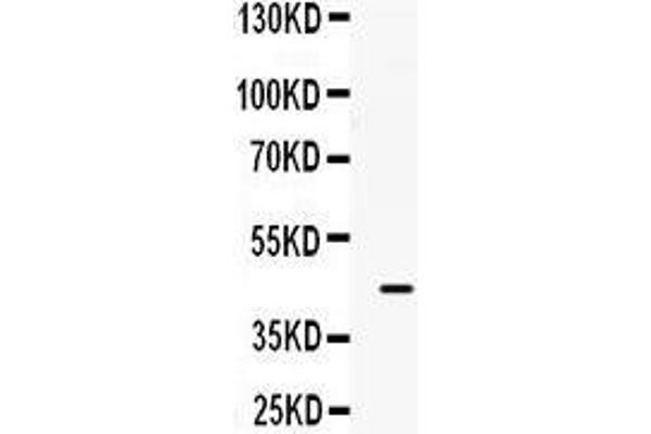 B3GNT8 antibody  (C-Term)