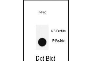 Dot blot analysis of anti-Phospho-Nanog- Antibody (ABIN390033 and ABIN2839783) on nitrocellulose membrane. (Nanog antibody  (pSer285))