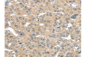 Immunohistochemistry (IHC) image for anti-Tumor Suppressor Candidate 2 (TUSC2) antibody (ABIN5958021)
