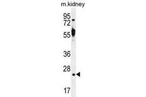 TTC9B Antibody (C-term) western blot analysis in mouse kidney tissue lysates (35 µg/lane). (TTC9B antibody  (C-Term))