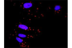 Proximity Ligation Analysis of protein-protein interactions between MAPK3 and ELK1. (ELK1 antibody  (AA 67-166))