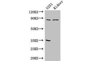 Western Blot Positive WB detected in: U251 whole cell lysate, Mouse kidney tissue All lanes: RPS6KA4 antibody at 3 μg/mL Secondary Goat polyclonal to rabbit IgG at 1/50000 dilution Predicted band size: 86, 85 kDa Observed band size: 86 kDa (MSK2 antibody  (AA 237-393))