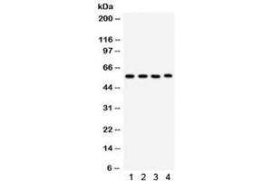 Western blot testing of 1) rat lung, 2) mouse lung, 3) human placenta, 4) Jurkat lysate with CYP1A1 antibody. (CYP1A1 antibody  (AA 183-320))