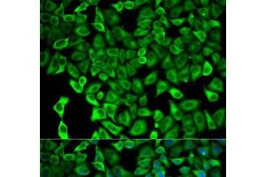 Immunofluorescence analysis of HeLa cells using PSMD2 Polyclonal Antibody (PSMD2 antibody)