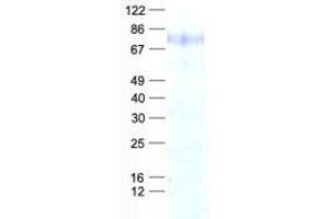 Validation with Western Blot