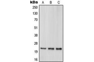 Western blot analysis of DJ-1 expression in HeLa (A), HEK293T (B), Jurkat (C) whole cell lysates. (PARK7/DJ1 antibody  (Center))