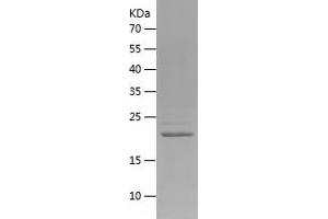 Western Blotting (WB) image for ADP-Ribosylation Factor 5 (ARF5) (AA 1-180) protein (His tag) (ABIN7121734) (ARF5 Protein (AA 1-180) (His tag))