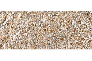 Immunohistochemistry of paraffin-embedded Human tonsil tissue using DTYMK Polyclonal Antibody at dilution of 1:70(x200) (DTYMK antibody)