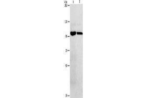 Western Blotting (WB) image for anti-Nuclear Factor of kappa Light Polypeptide Gene Enhancer in B-Cells 1 (NFKB1) antibody (ABIN2427644) (NFKB1 antibody)