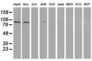 Image no. 3 for anti-Protein Kinase C, epsilon (PRKCE) antibody (ABIN1500235) (PKC epsilon antibody)