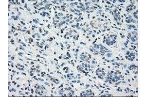 Immunohistochemical staining of paraffin-embedded breast tissue using anti-STAT1 mouse monoclonal antibody. (STAT1 antibody)