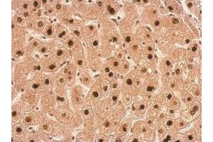 IHC-P Image Transaldolase antibody detects TALDO1 protein at nucleus on human hepatoma by immunohistochemical analysis. (TALDO1 antibody  (N-Term))