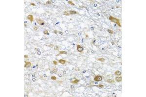 Immunohistochemistry (IHC) image for anti-DEAD (Asp-Glu-Ala-Asp) Box Polypeptide 39A (DDX39) (AA 178-427) antibody (ABIN6139489)